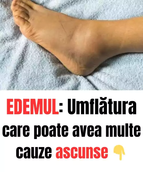 894215a0003fc6f2ed396c3437b51d39